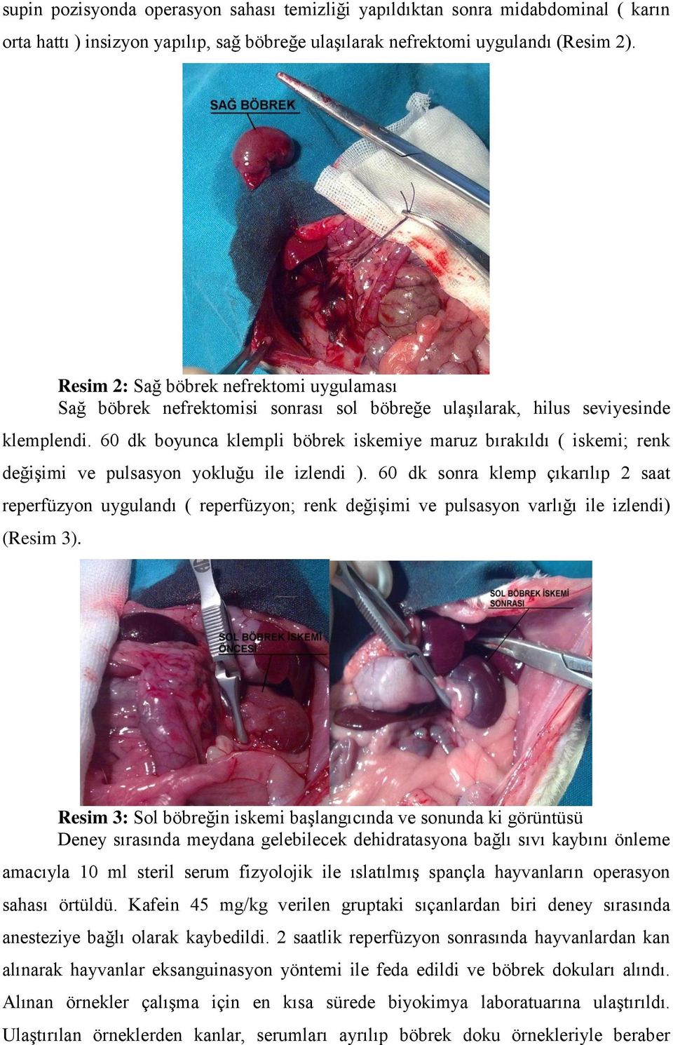 60 dk boyunca klempli böbrek iskemiye maruz bırakıldı ( iskemi; renk değişimi ve pulsasyon yokluğu ile izlendi ).