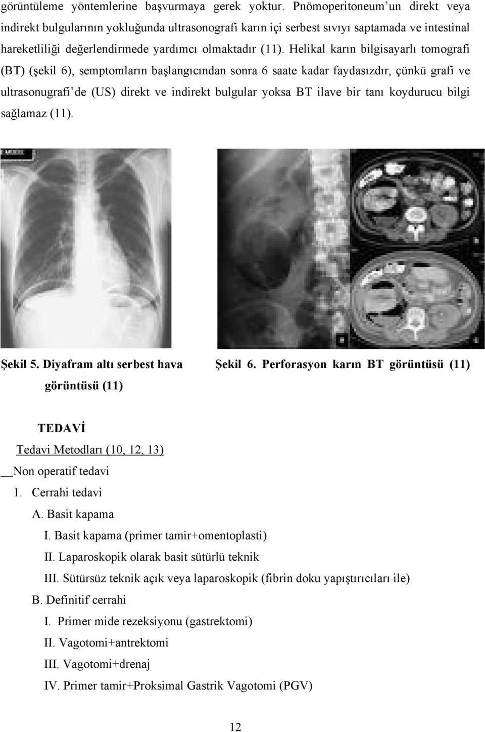 Helikal karın bilgisayarlı tomografi (BT) (şekil 6), semptomların başlangıcından sonra 6 saate kadar faydasızdır, çünkü grafi ve ultrasonugrafi de (US) direkt ve indirekt bulgular yoksa BT ilave bir