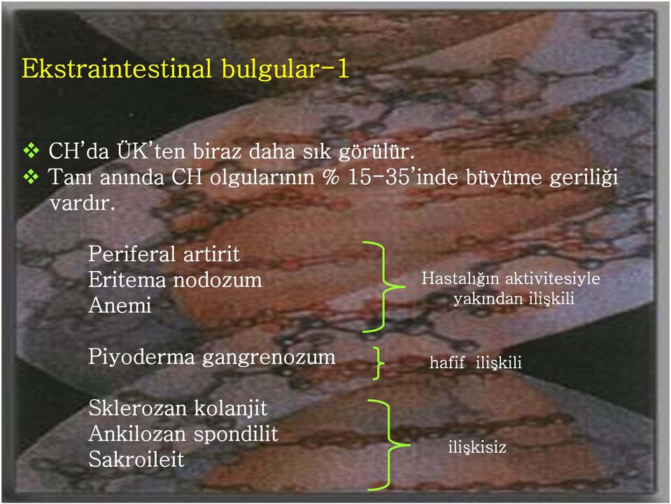 Periferal artirit Eritema nodozum Anemi Piyoderma gangrenozum Sklerozan