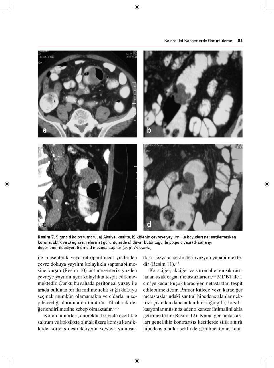 Sigmoid mezod Lp lr (c). (G.