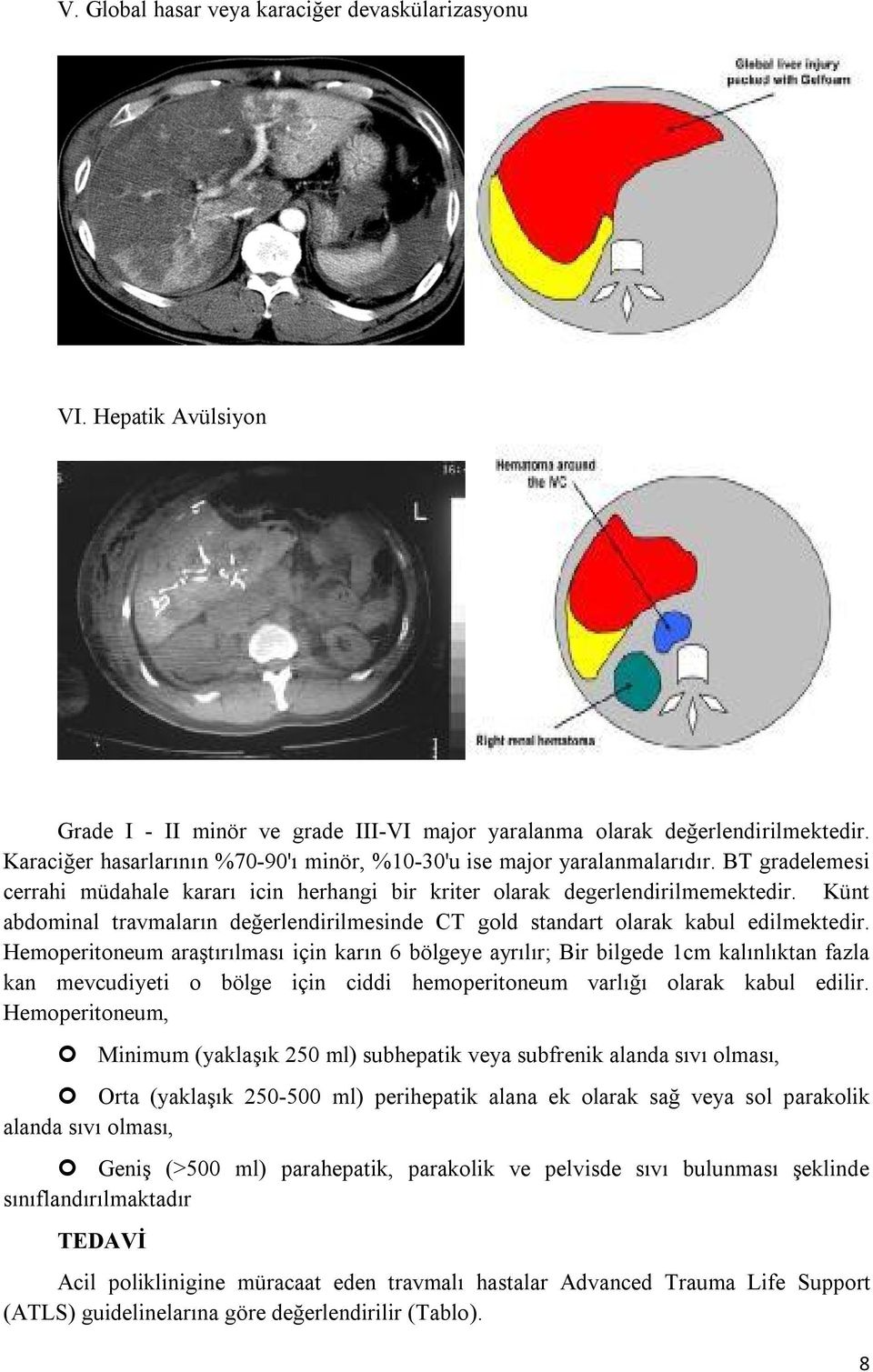 Künt abdominal travmaların değerlendirilmesinde CT gold standart olarak kabul edilmektedir.