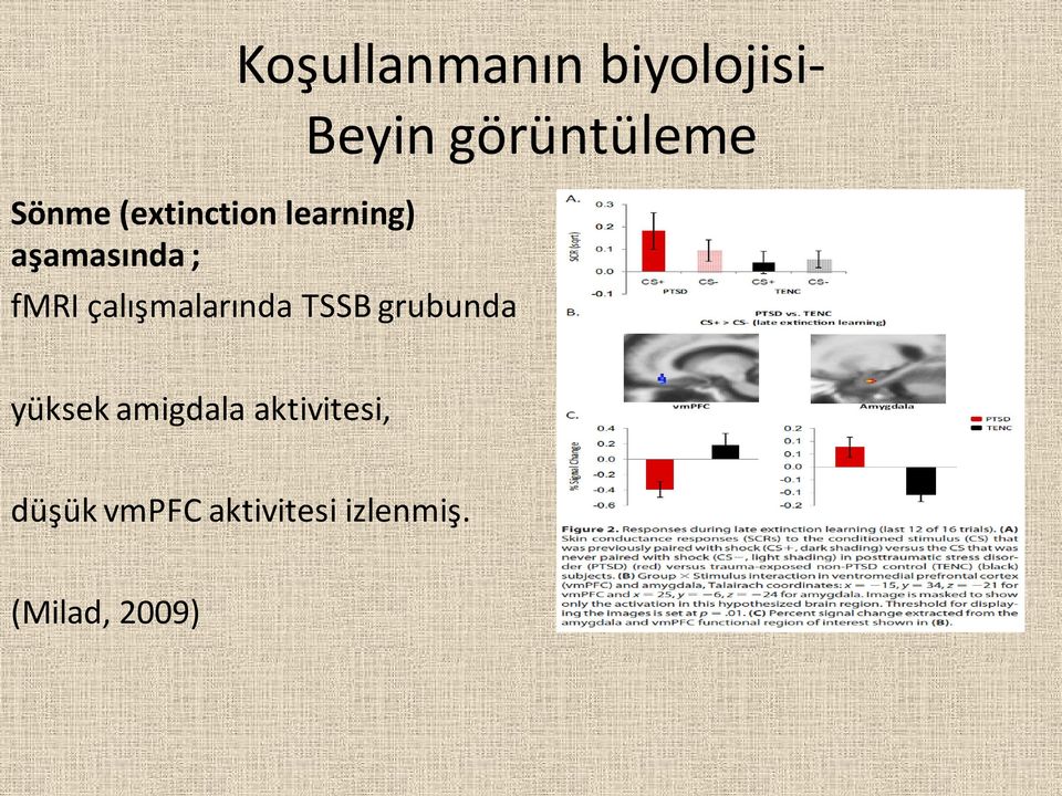 TSSB grubunda Beyin görüntüleme yüksek amigdala