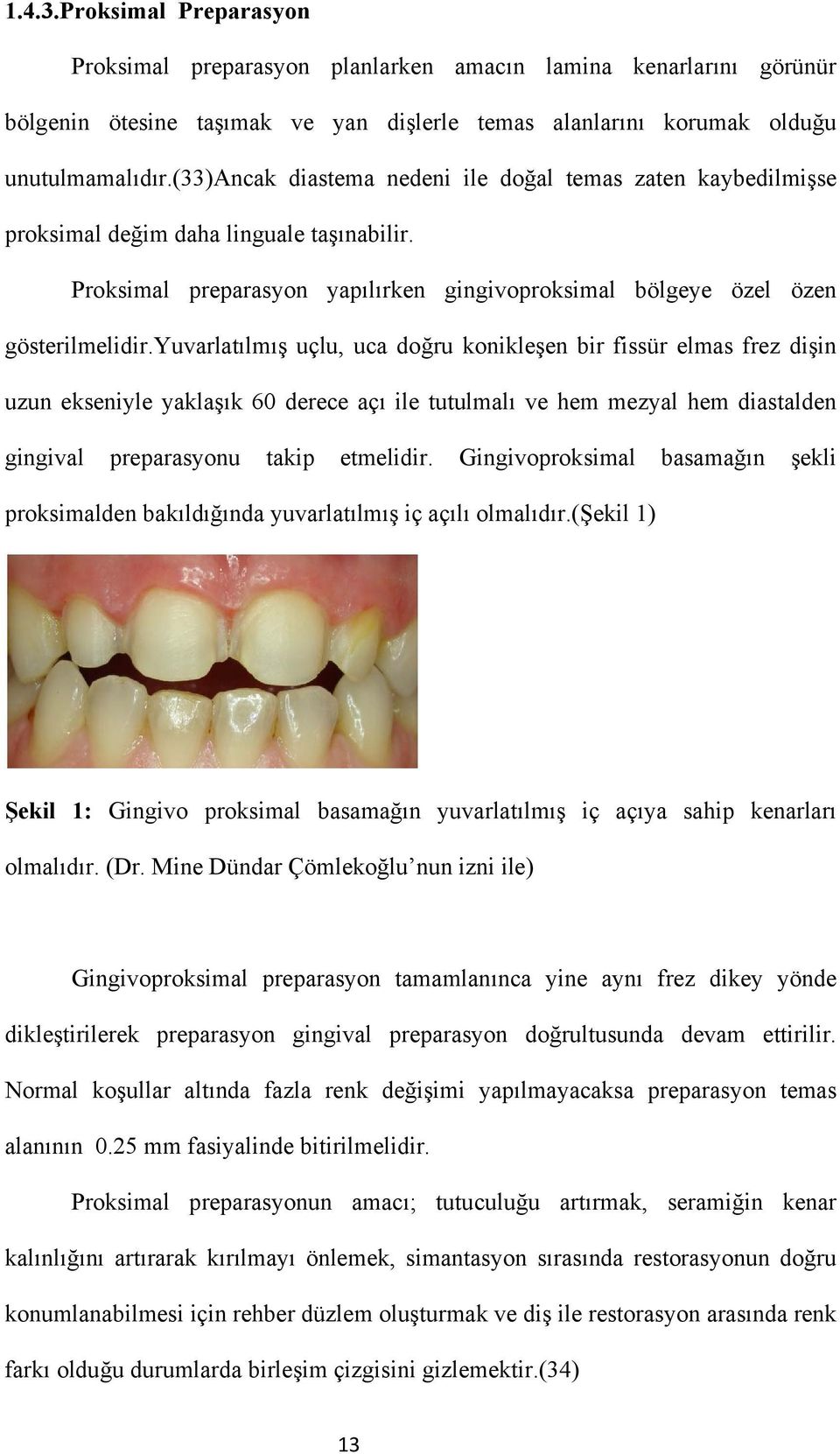 yuvarlatılmış uçlu, uca doğru konikleşen bir fissür elmas frez dişin uzun ekseniyle yaklaşık 60 derece açı ile tutulmalı ve hem mezyal hem diastalden gingival preparasyonu takip etmelidir.