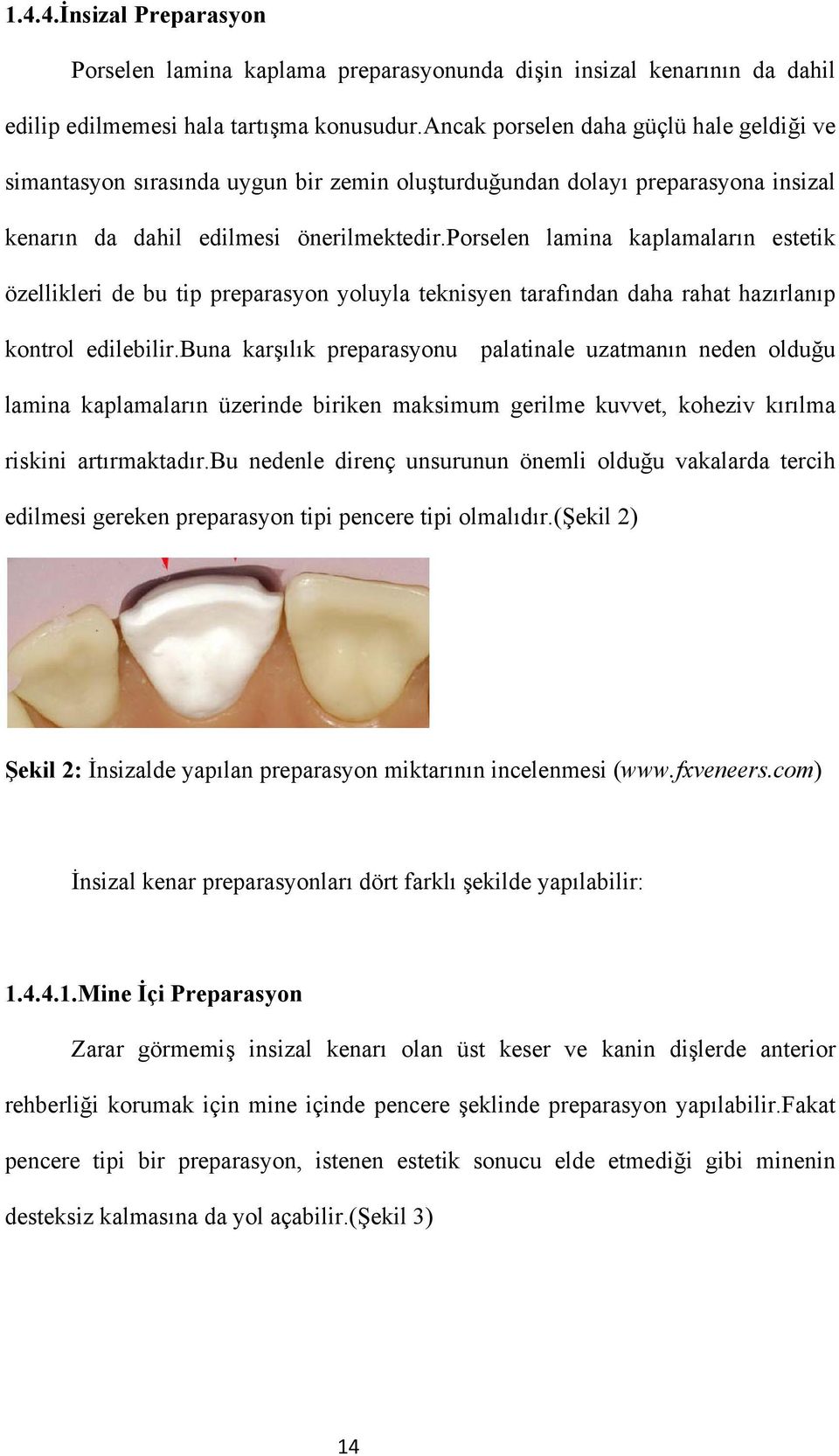 porselen lamina kaplamaların estetik özellikleri de bu tip preparasyon yoluyla teknisyen tarafından daha rahat hazırlanıp kontrol edilebilir.