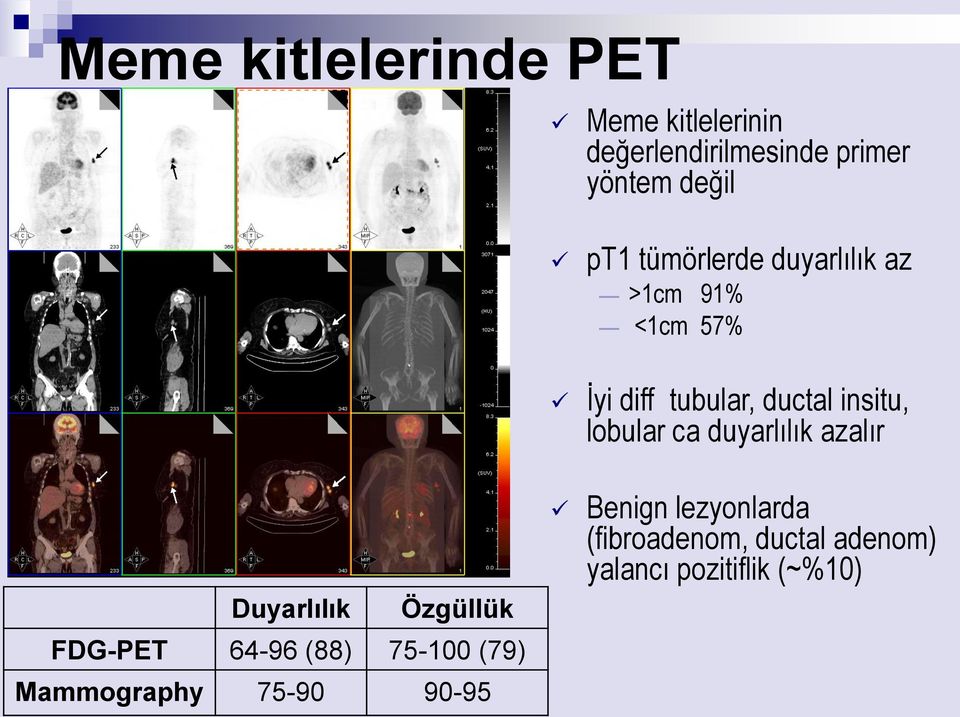 ca duyarlılık azalır Duyarlılık Özgüllük FDG-PET 64-96 (88) 75-100 (79) Mammography