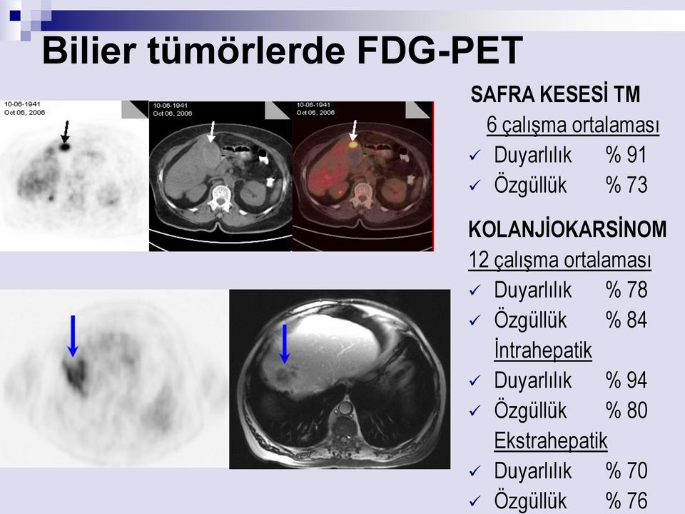 Ekstrahepatik Duyarlılık % 70 Özgüllük % 76 Bilier tümörlerde