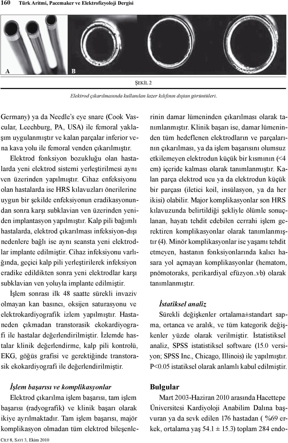 Elektrod fonksiyon bozukluğu olan hastalarda yeni elektrod sistemi yerleştirilmesi aynı ven üzerinden yapılmıştır.