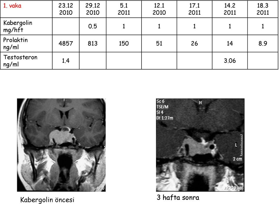 Testosteron ng/ml 29.12 2010 5.1 2011 12.1 2010 17.