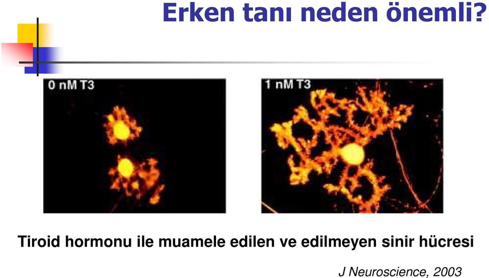 edilen ve edilmeyen sinir