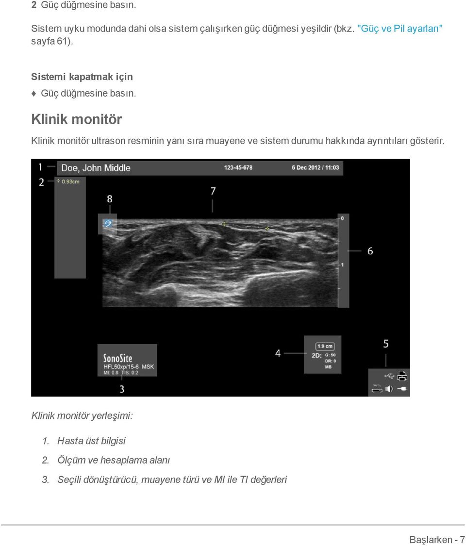Klinik monitör Klinik monitör ultrason resminin yanı sıra muayene ve sistem durumu hakkında ayrıntıları