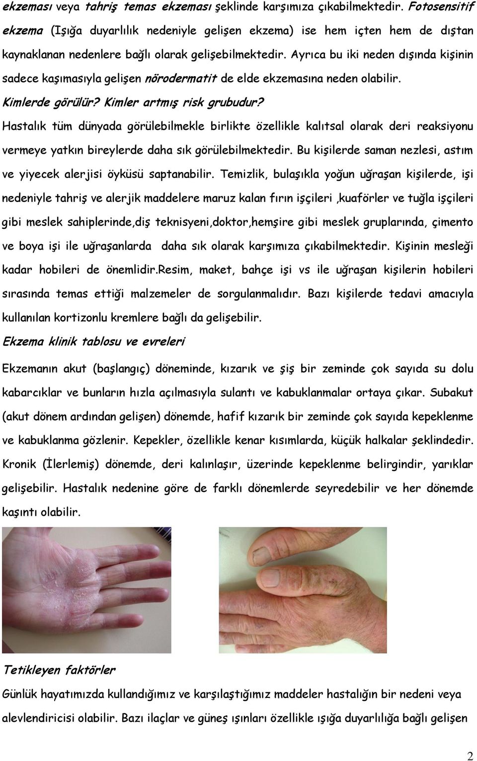 Ayrıca bu iki neden dışında kişinin sadece kaşımasıyla gelişen nörodermatit de elde ekzemasına neden olabilir. Kimlerde görülür? Kimler artmış risk grubudur?