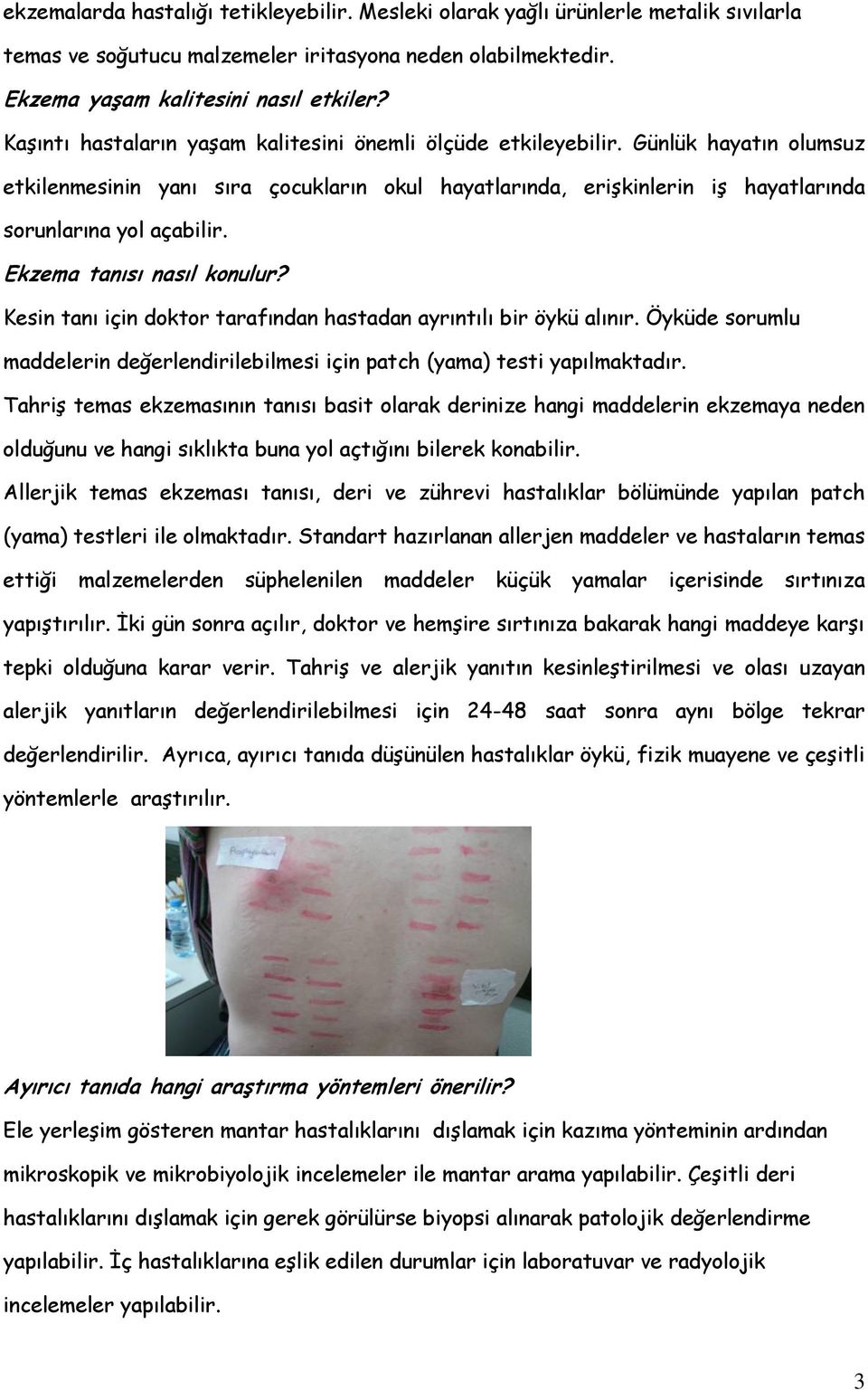 Ekzema tanısı nasıl konulur? Kesin tanı için doktor tarafından hastadan ayrıntılı bir öykü alınır. Öyküde sorumlu maddelerin değerlendirilebilmesi için patch (yama) testi yapılmaktadır.