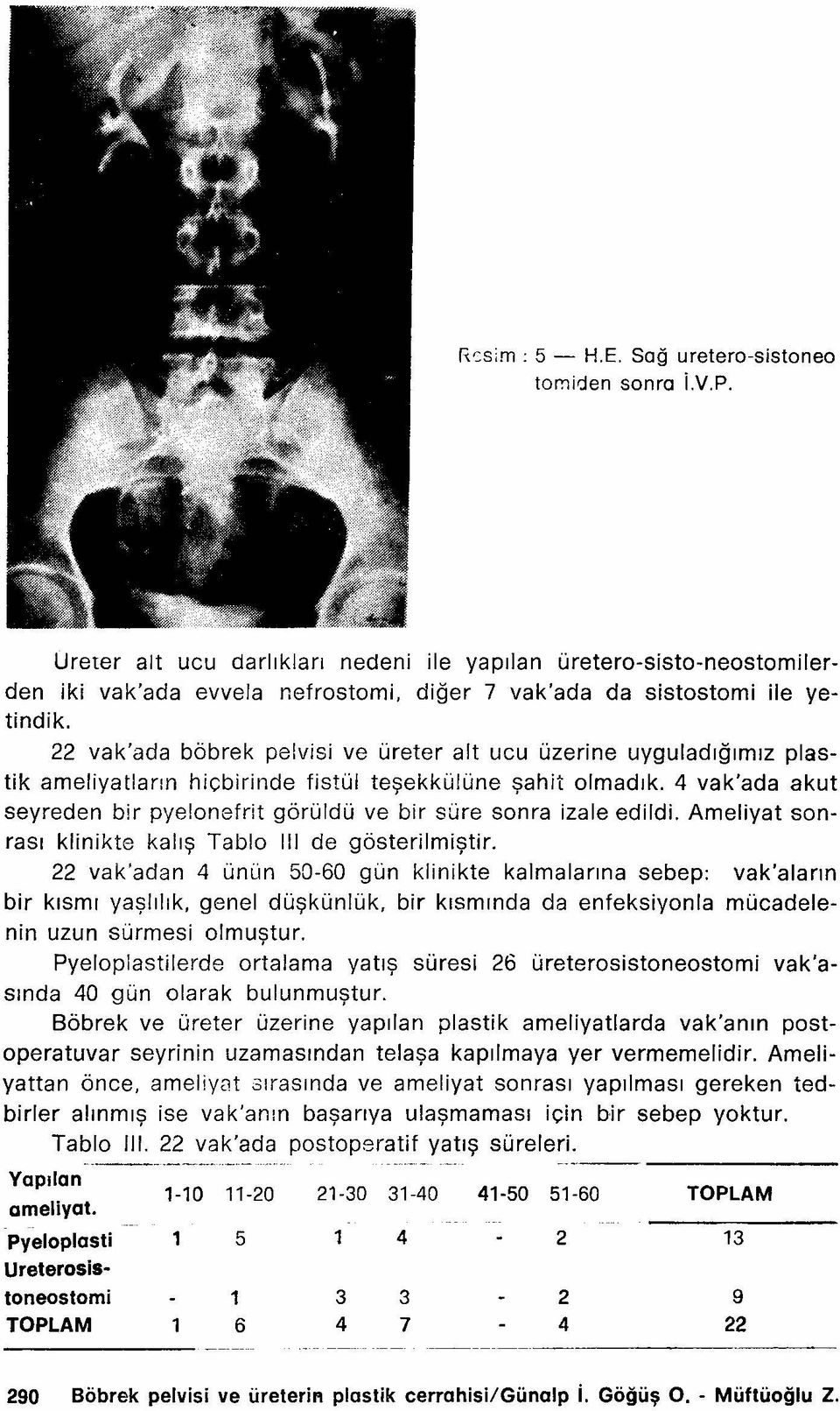 22 vak'ada böbrek pelvisi ve üreter alt ucu üzerine uyguladığımız plastik ameliyatlann hiçbirinde fistül teşekkülüne şahit olmadık.