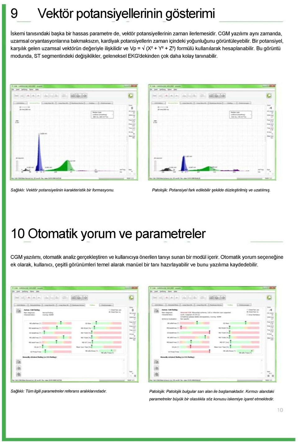 Bir potansiyel, karşılık gelen uzamsal vektörün değeriyle ilişkilidir ve Vp = (X² + Y² + Z²) formülü kullanılarak hesaplanabilir.