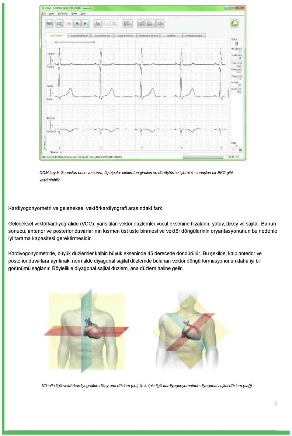 Bunun sonucu, anterior ve posterior duvarlarının kısmen üst üste binmesi ve vektör döngülerinin oryantasyonunun bu nedenle iyi tarama kapasitesi gerektirmesidir.