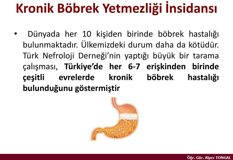 Türk Nefroloji Derneği nin yaptığı büyük bir tarama çalışması, Türkiye de