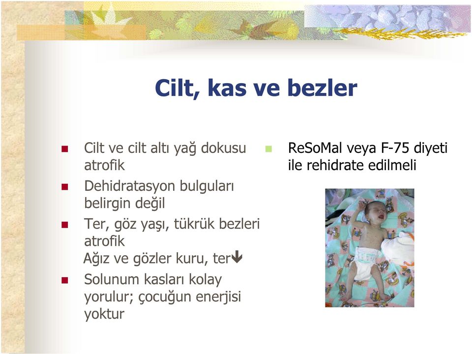 bezleri atrofik Ağız ve gözler kuru, ter Solunum kasları kolay