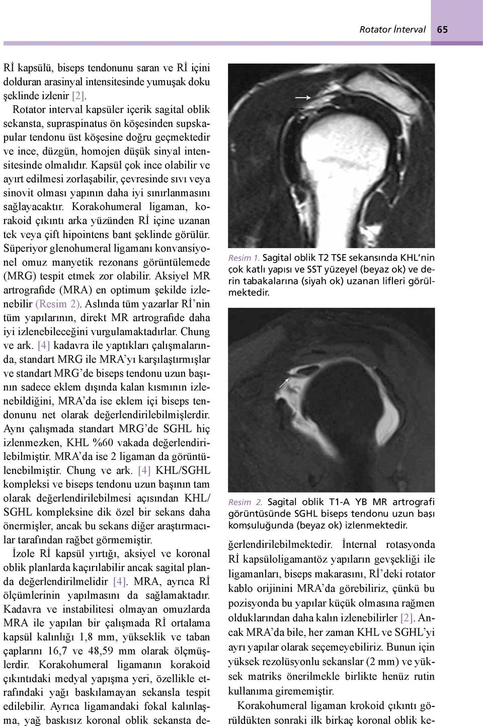Rİ kapsülü, biseps tendonunu saran ve Rİ içini dolduran arasinyal intensitesinde yumuşak doku şeklinde izlenir [2].