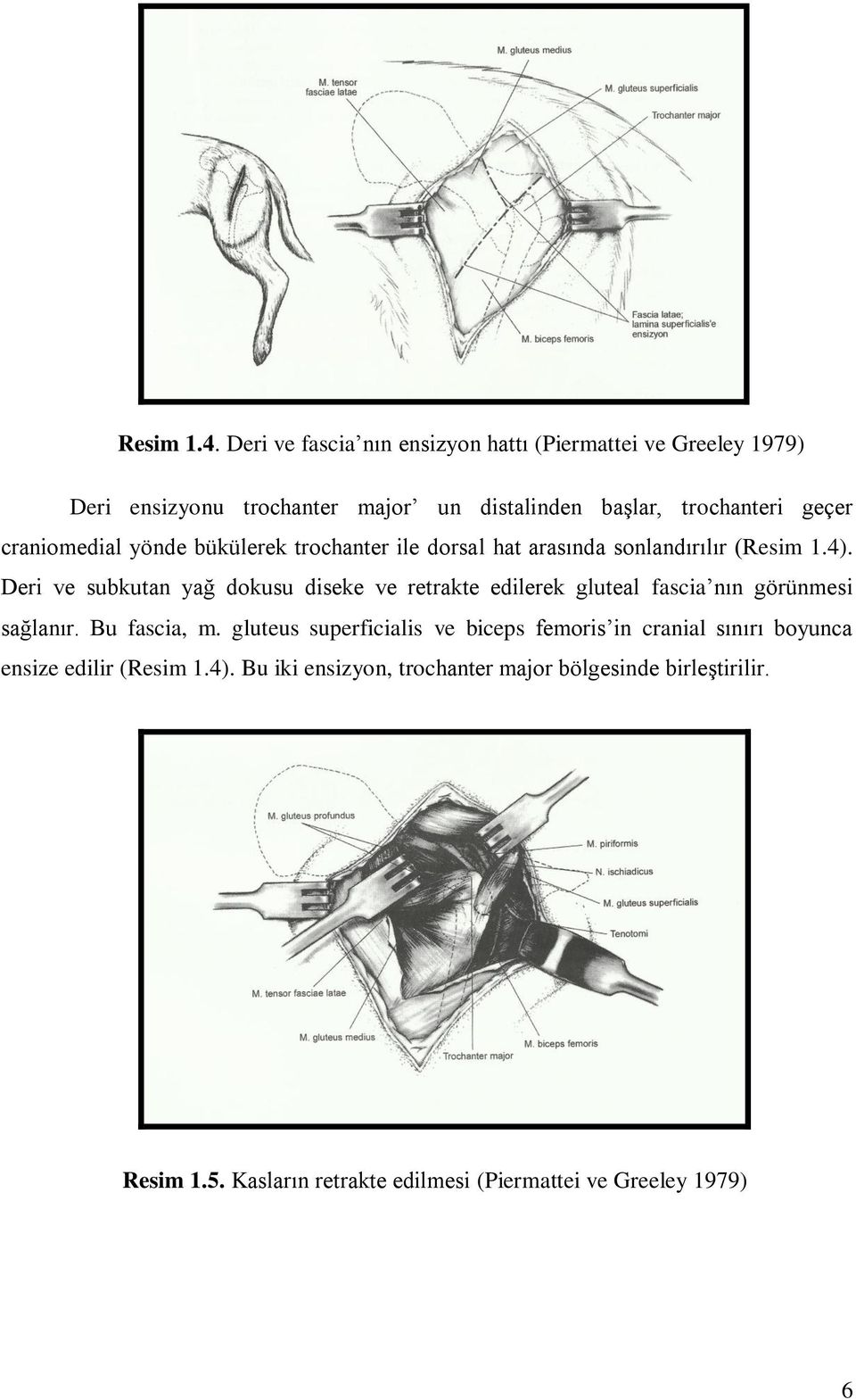 craniomedial yönde bükülerek trochanter ile dorsal hat arasında sonlandırılır (Resim 1.4).