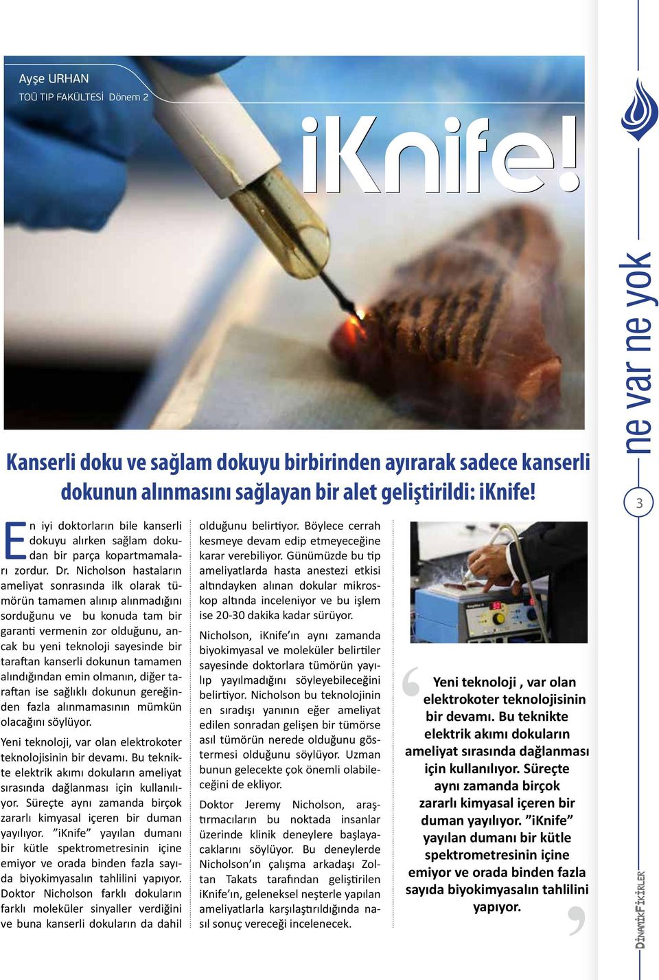 Nicholson hastaların ameliyat sonrasında ilk olarak tümörün tamamen alınıp alınmadığını sorduğunu ve bu konuda tam bir garanti vermenin zor olduğunu, ancak bu yeni teknoloji sayesinde bir taraftan