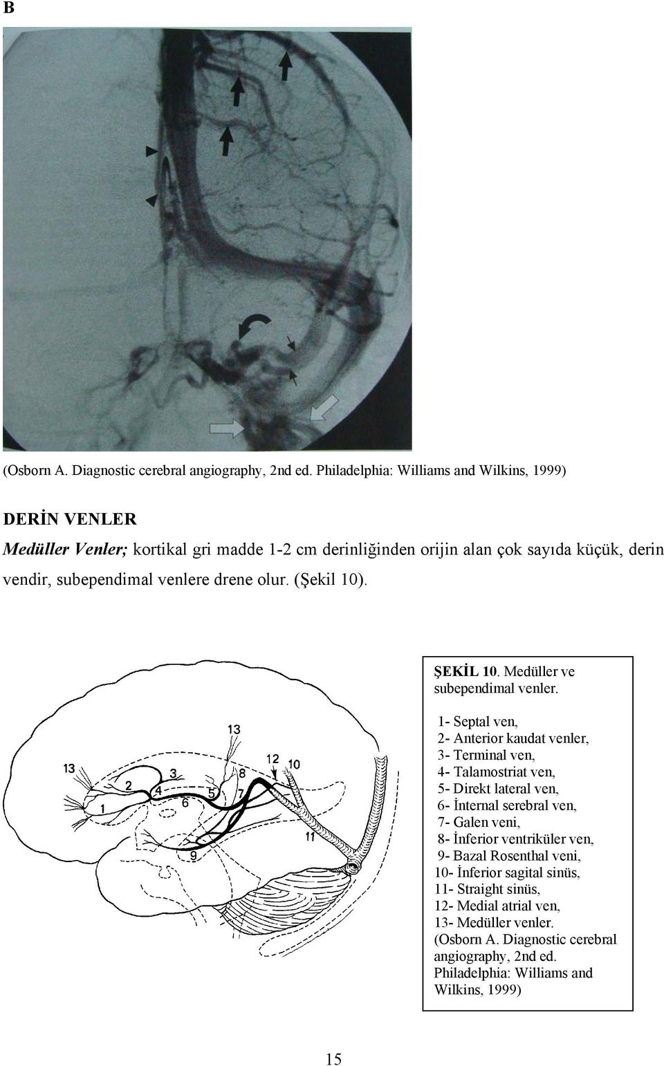 venlere drene olur. (Şekil 10). ŞEKİL 10. Medüller ve subependimal venler.