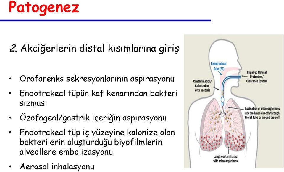 aspirasyonu Endotrakeal tüpün kaf kenarından bakteri sızması