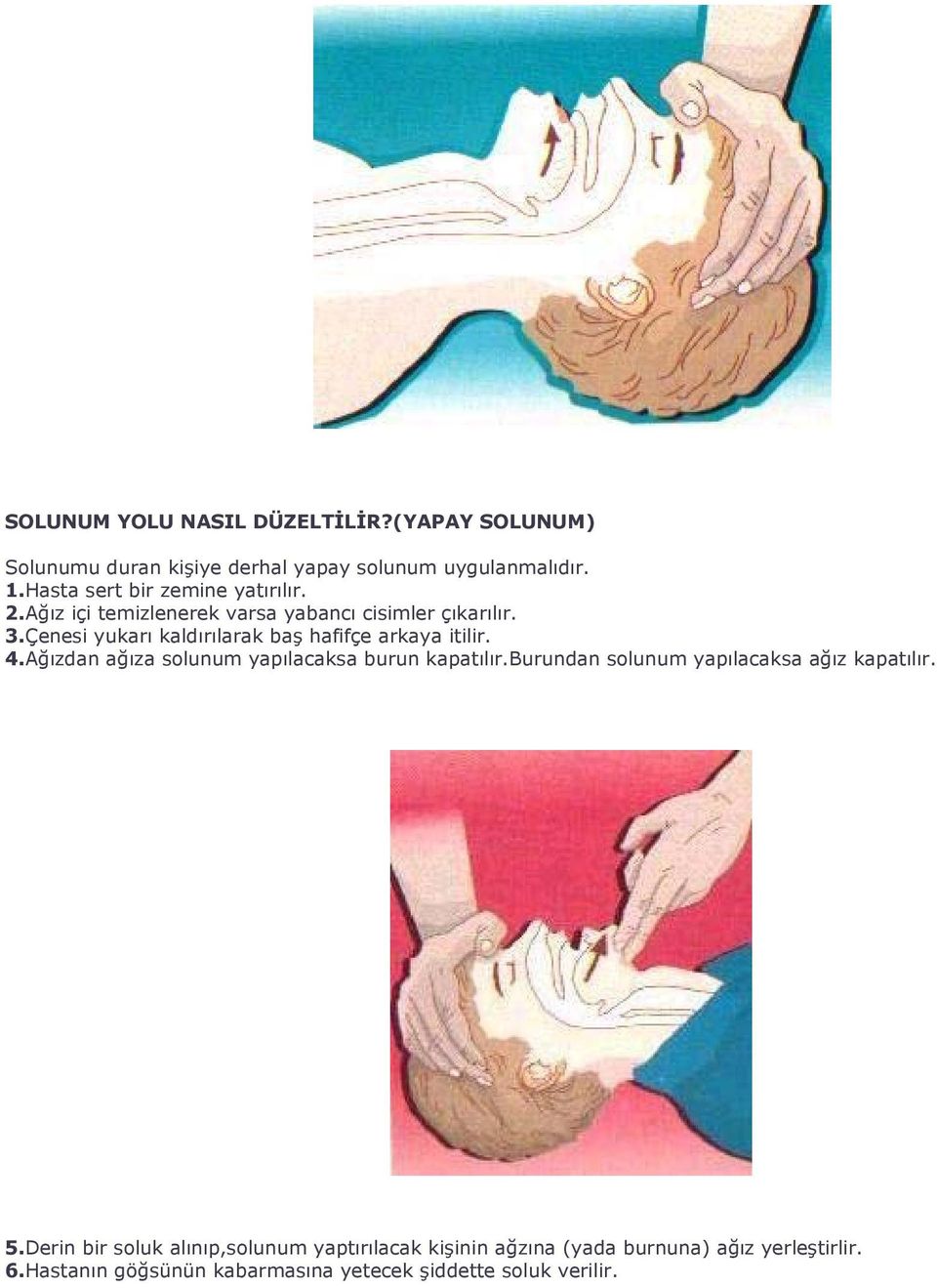 Çenesi yukarı kaldırılarak baş hafifçe arkaya itilir. 4.Ağızdan ağıza solunum yapılacaksa burun kapatılır.