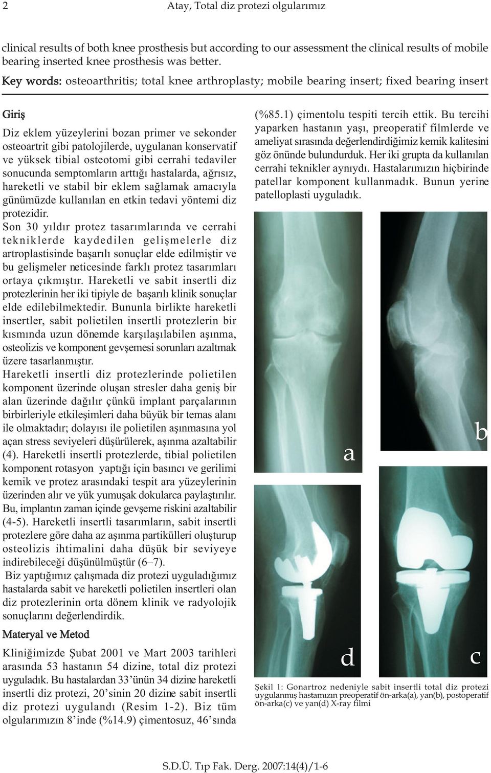 konservatif ve yüksek tibial osteotomi gibi cerrahi tedaviler sonucunda semptomlarýn arttýðý hastalarda, aðrýsýz, hareketli ve stabil bir eklem saðlamak amacýyla günümüzde kullanýlan en etkin tedavi