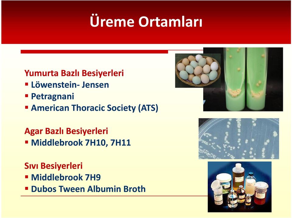 Society (ATS) Agar Bazlı Besiyerleri Middlebrook