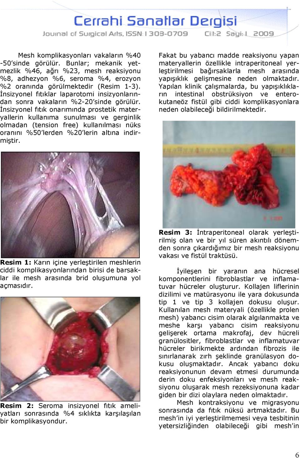 Đnsizyonel fıtık onarımında prostetik materyallerin kullanıma sunulması ve gerginlik olmadan (tension free) kullanılması nüks oranını %50 lerden %20 lerin altına indirmiştir.