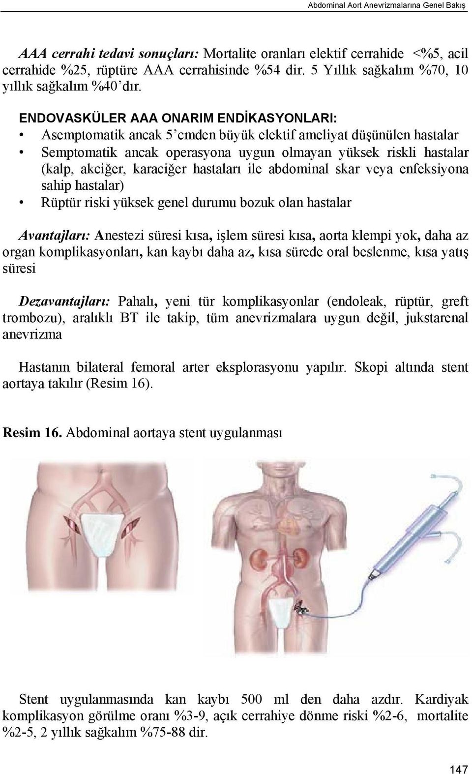 ENDOVASKÜLER AAA ONARIM ENDİKASYONLARI: Asemptomatik ancak 5 cmden büyük elektif ameliyat düşünülen hastalar Semptomatik ancak operasyona uygun olmayan yüksek riskli hastalar (kalp, akciğer,