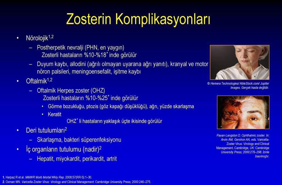 skarlaşma Keratit Deri tutulumları 2 OHZ li hastaların yaklaşık üçte ikisinde görülür Skarlaşma, bakteri süperenfeksiyonu İç organların tutulumu (nadir) 2 Hepatit, miyokardit, perikardit, artrit