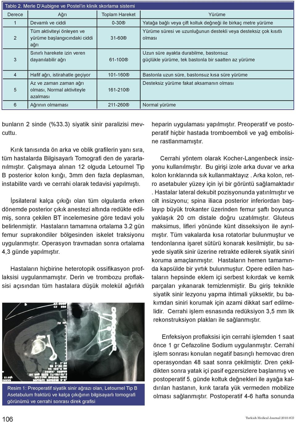 ve yürüme başlangıcındaki ciddi 31-60 ağrı Sınırlı harekete izin veren dayanılabilir ağrı 61-100 Yürüme süresi ve uzunluğunun destekli veya desteksiz çok kısıtlı olması Uzun süre ayakta durabilme,