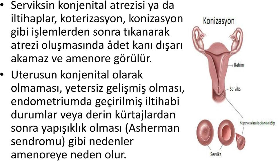 Uterusun konjenital olarak olmaması, yetersiz gelişmiş olması, endometriumda geçirilmiş