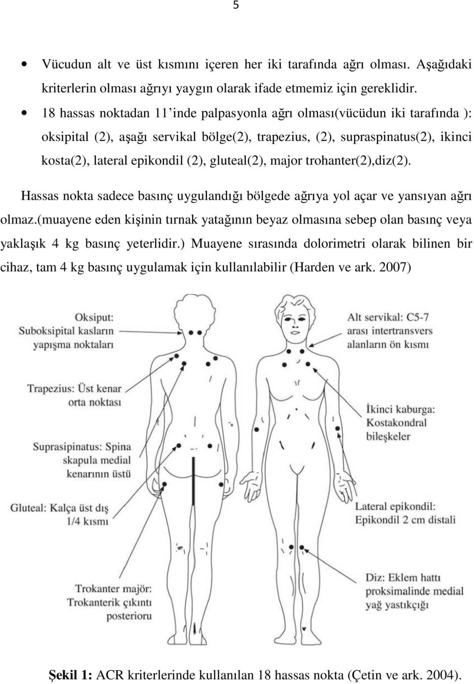 gluteal(2), major trohanter(2),diz(2). Hassas nokta sadece basınç uygulandığı bölgede ağrıya yol açar ve yansıyan ağrı olmaz.