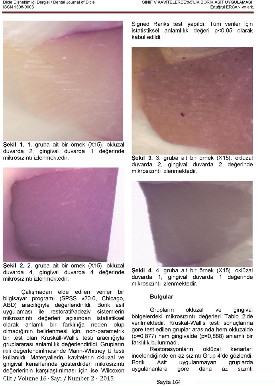 Şekil 2. 2. gruba ait bir örnek (X15). oklüzal duvarda 4, gingival duvarda 4 değerinde mikrosızıntı izlenmektedir. Çalışmadan elde edilen veriler bir bilgisayar programı (SPSS v20.