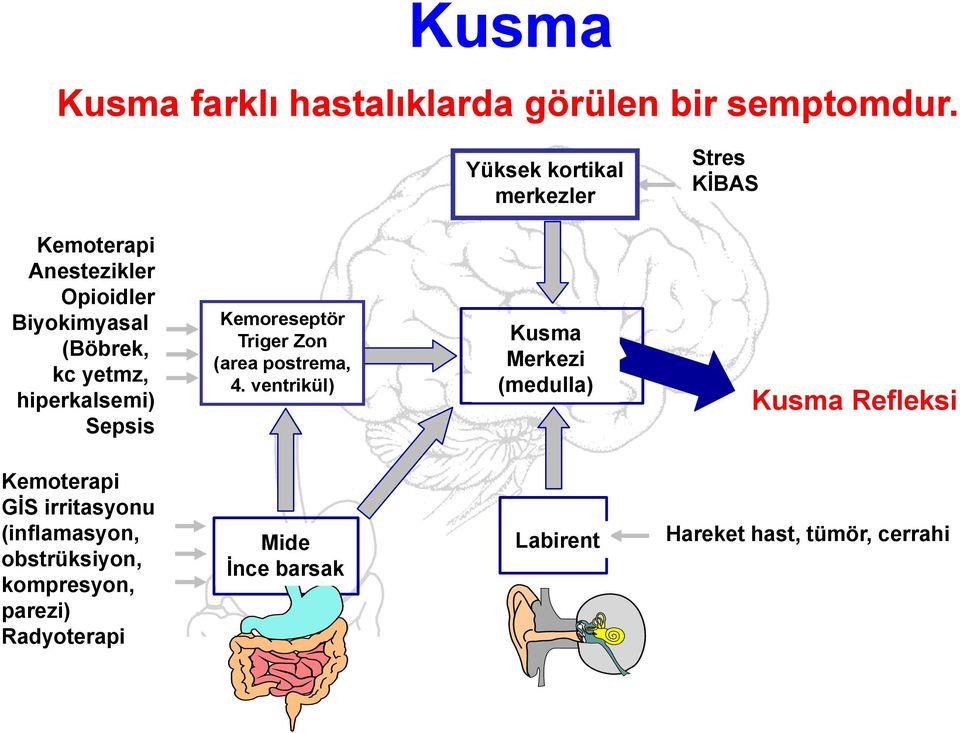 Opioids hiperkalsemi) Sepsis Kemoreseptör Chemoreceptor Trigger Triger Zone (area prostrema, postrema, 4.