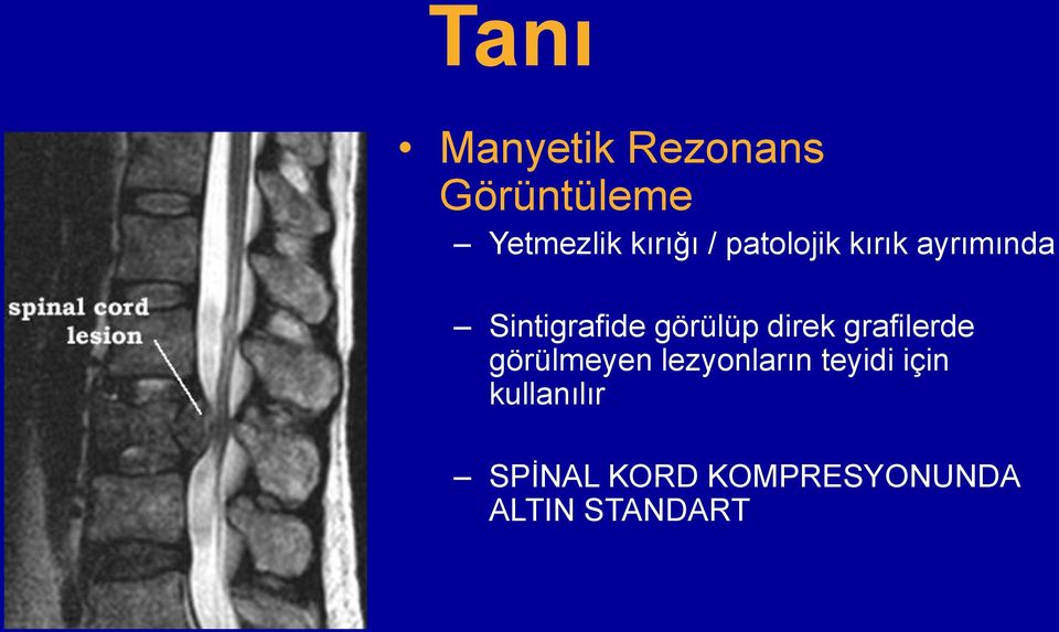 direk grafilerde görülmeyen lezyonların teyidi için