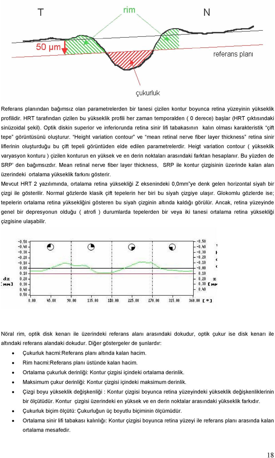 Optik diskin superior ve inferiorunda retina sinir lifi tabakasının kalın olması karakteristik çift tepe görüntüsünü oluşturur.