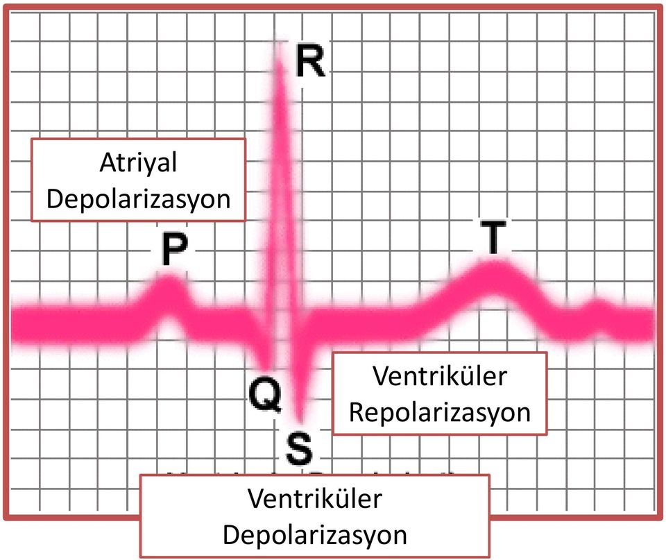 Ventriküler