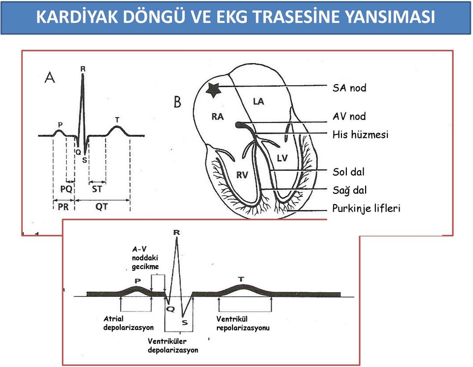 lifleri A-V noddaki gecikme Atrial