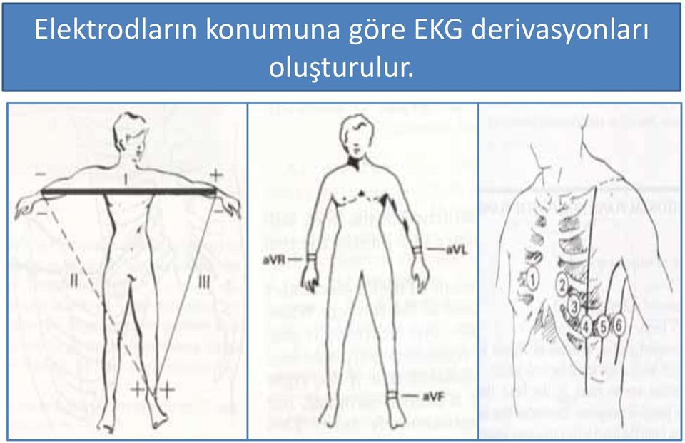 EKG