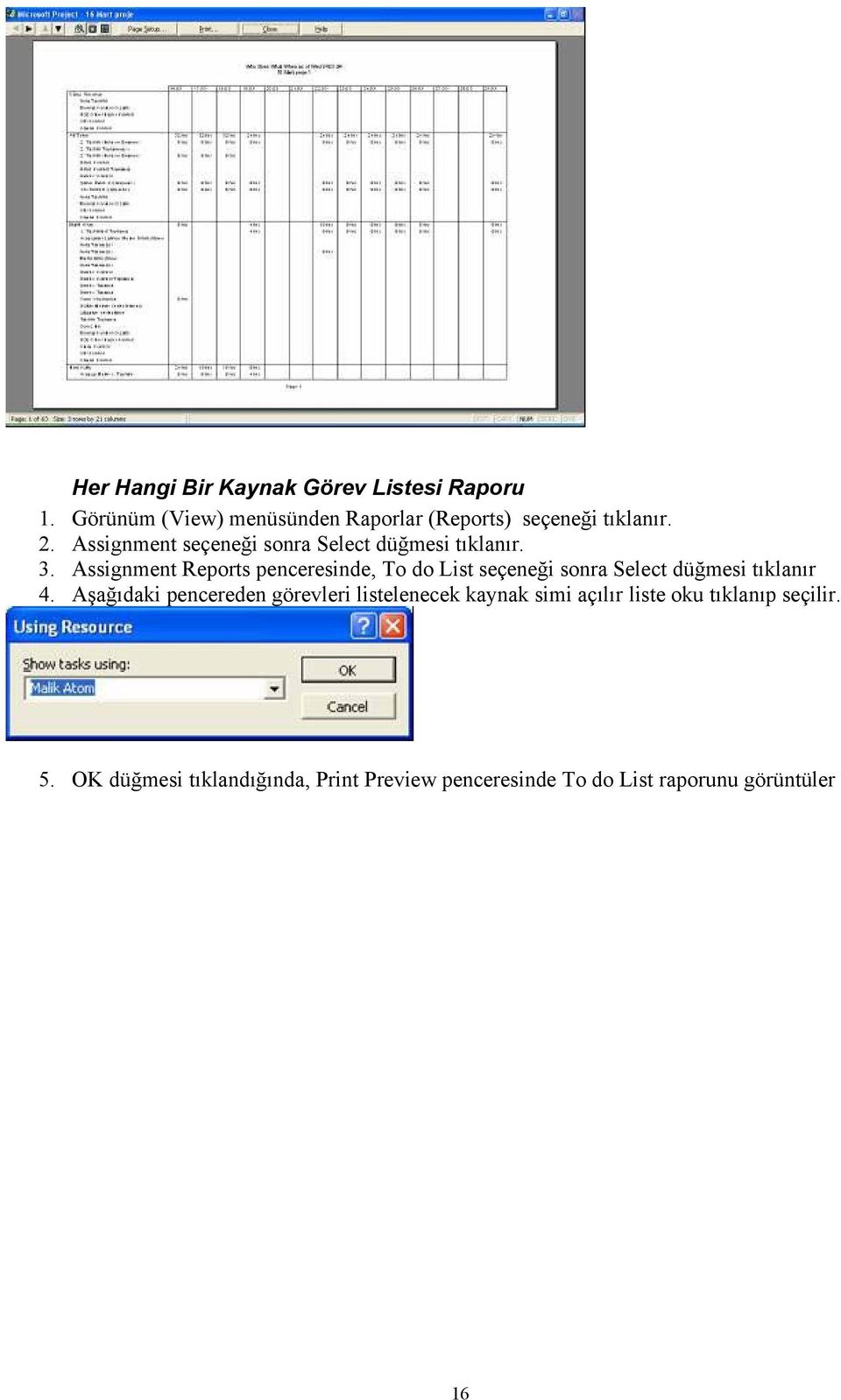 Assignment Reports penceresinde, To do List seçeneği sonra Select düğmesi tıklanır 4.