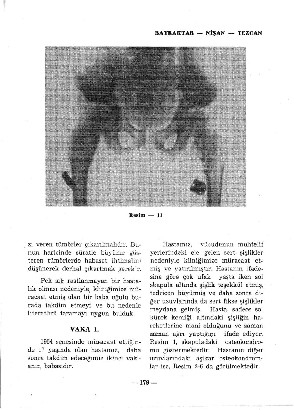 1954 s~nesinde mw:acaat ettiğinde 17 yaşında olan hastamız, daha sonra takdim edeceğimiz iki.nci vak' - anın babasıdır.