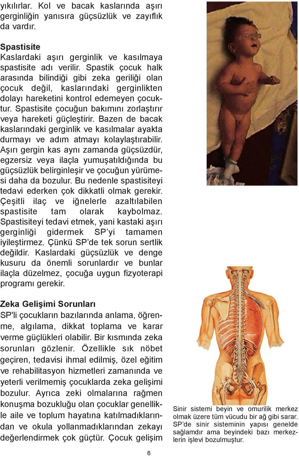 Spastisite çocuðun bakýmýný zorlaþtýrýr veya hareketi güçleþtirir. Bazen de bacak kaslarýndaki gerginlik ve kasýlmalar ayakta durmayý ve adým atmayý kolaylaþtýrabilir.