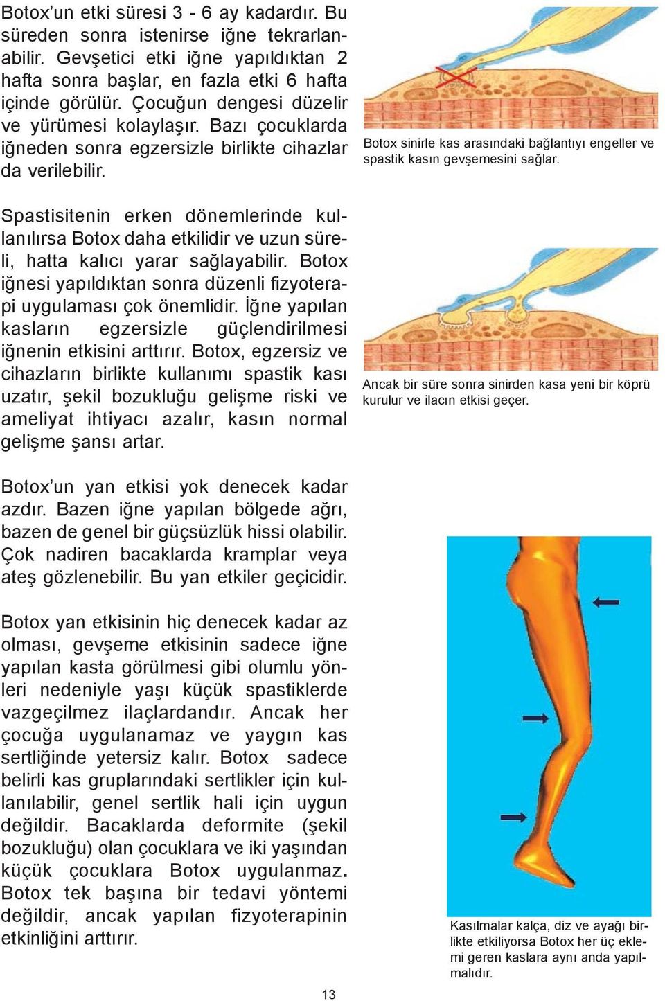 Botox sinirle kas arasýndaki baðlantýyý engeller ve spastik kasýn gevþemesini saðlar.