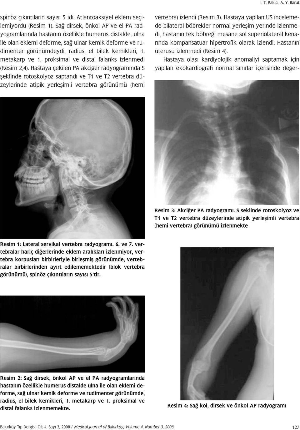 metakarp ve 1. proksimal ve distal falanks izlenmedi (Resim 2,4).