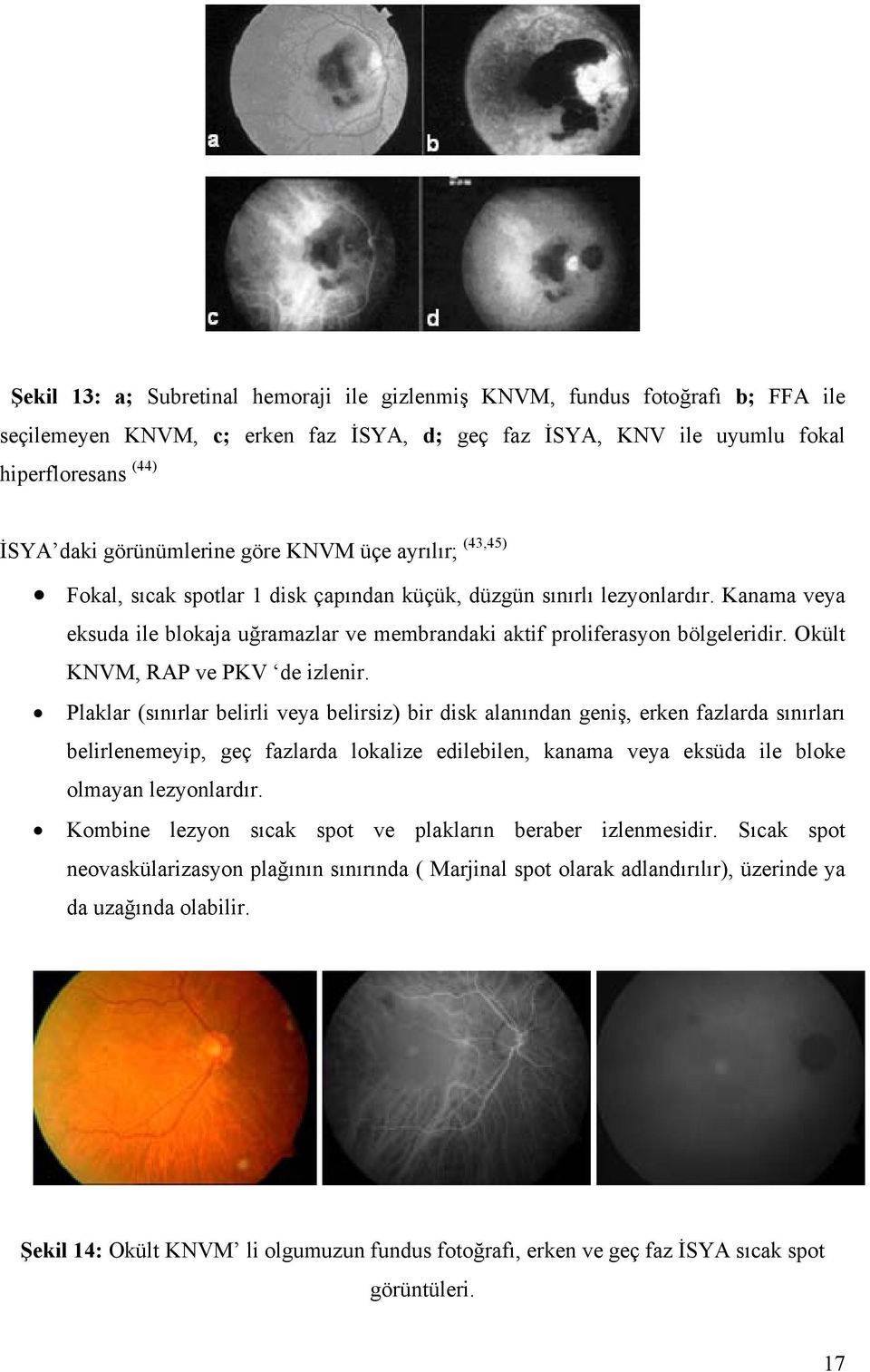 Okült KNVM, RAP ve PKV de izlenir.