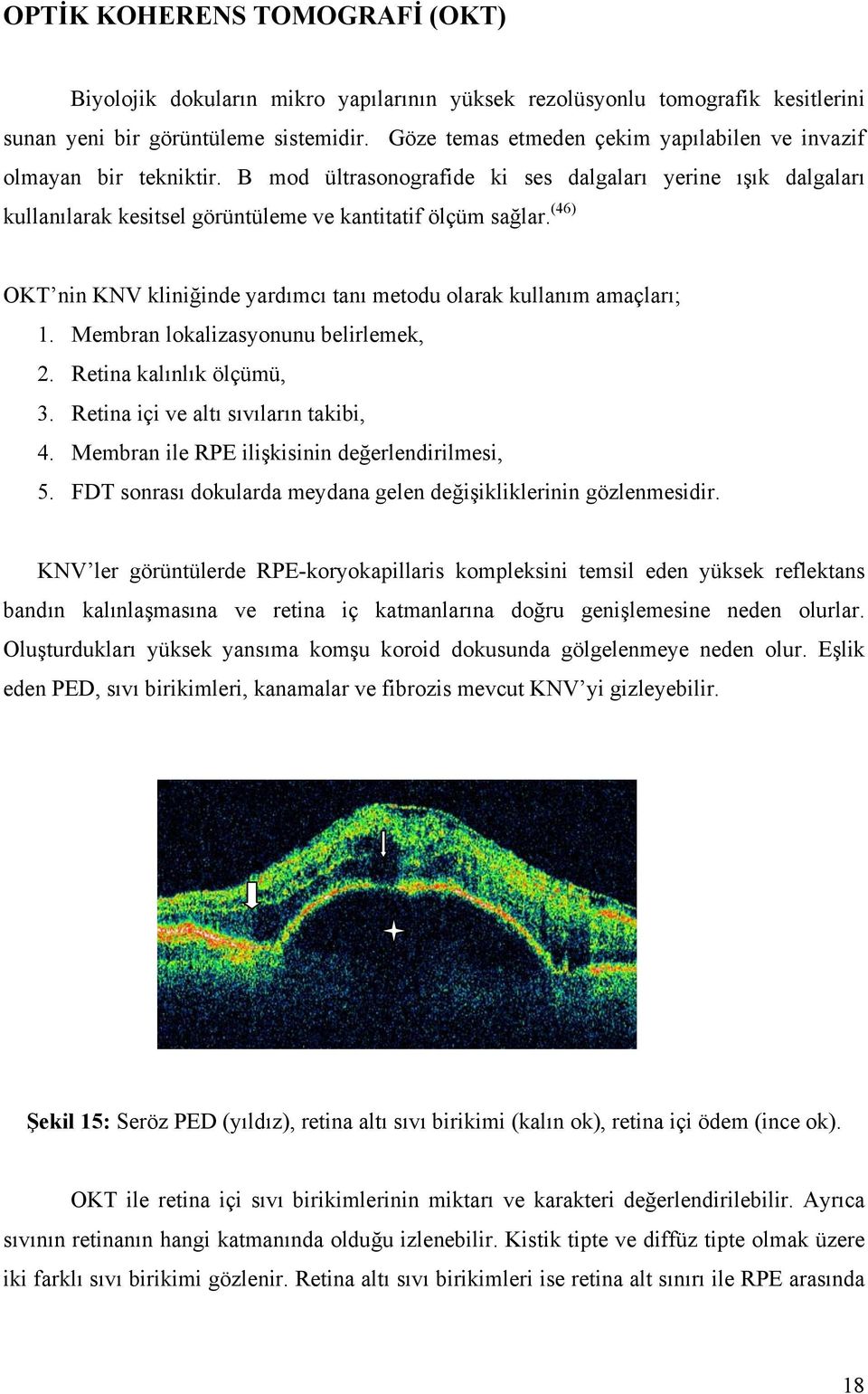 (46) OKT nin KNV kliniğinde yardımcı tanı metodu olarak kullanım amaçları; 1. Membran lokalizasyonunu belirlemek, 2. Retina kalınlık ölçümü, 3. Retina içi ve altı sıvıların takibi, 4.
