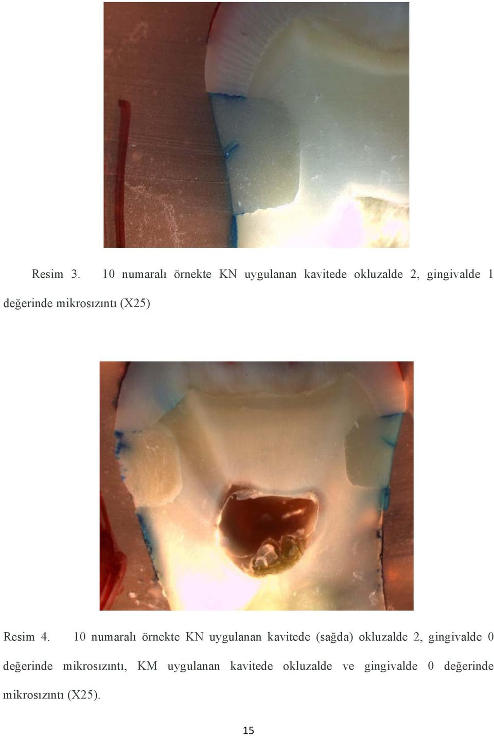 değerinde mikrosızıntı (X25) Resim 4.